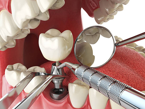 Best After-Hours Dental Care in Meadow Les, AK